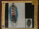 Bacteria drawings done through microscope by Dr. Donaghy