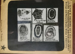 Bacteria drawings done through microscope by Dr. Donaghy