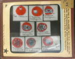 Bacteria drawings done through microscope by Dr. Donaghy