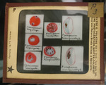 Bacteria drawings done through microscope by Dr. Donaghy