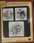 Bacteria drawings done through microscope by Dr. Donaghy