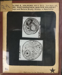 Bacteria drawings done through microscope by Dr. Donaghy
