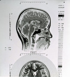 X-ray scan of brain/skull by Myong Ahn