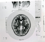 X-ray scan of brain/skull by Myong Ahn